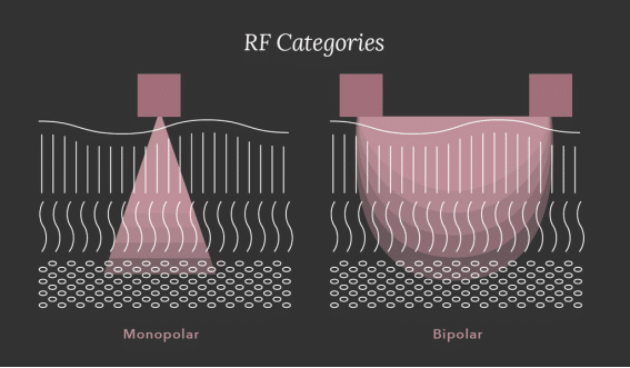 How does monopolar RF work?